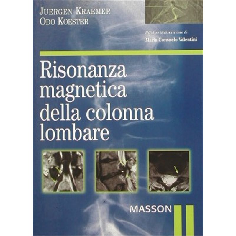 Risonanza magnetica della colonna lombare